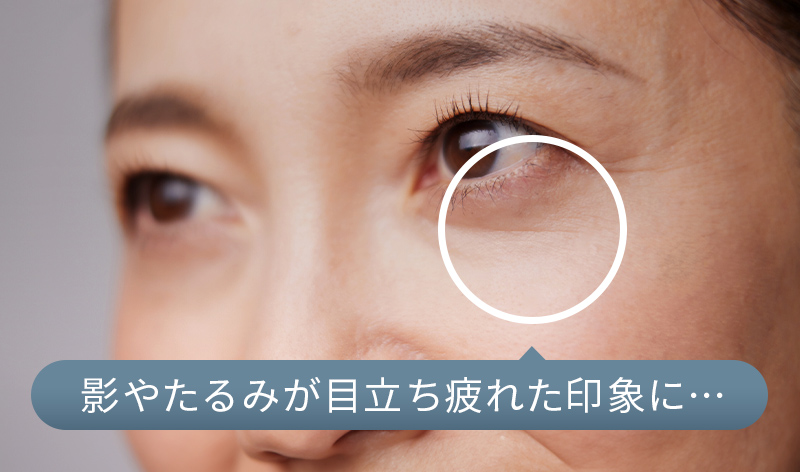 影やたるみが目立ち疲れた印象に…
